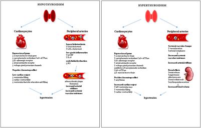 Hypertension in Thyroid Disorders